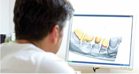 奥塔哥大学牙科技术本科毕业生可注册成为牙科技术师